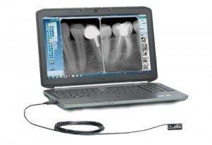 Radiowizjografia (cyfrowe RTG zębów, RVG)